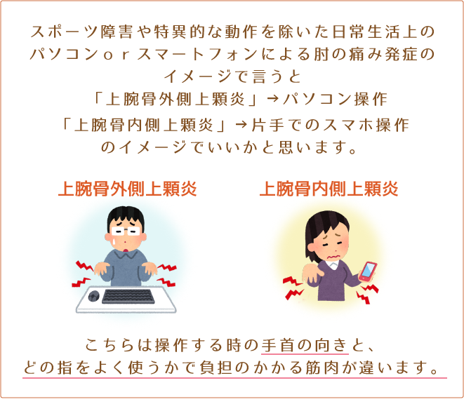 スポーツ障害や特異的な動作を除いた日常生活上のパソコンorスマートフォンによる肘の痛みの発症イメージで言うと…「上腕骨外側上顆炎」→パソコン操作/「上腕骨内側上顆炎」→片手でのスマホ操作のイメージでよいかと思います。